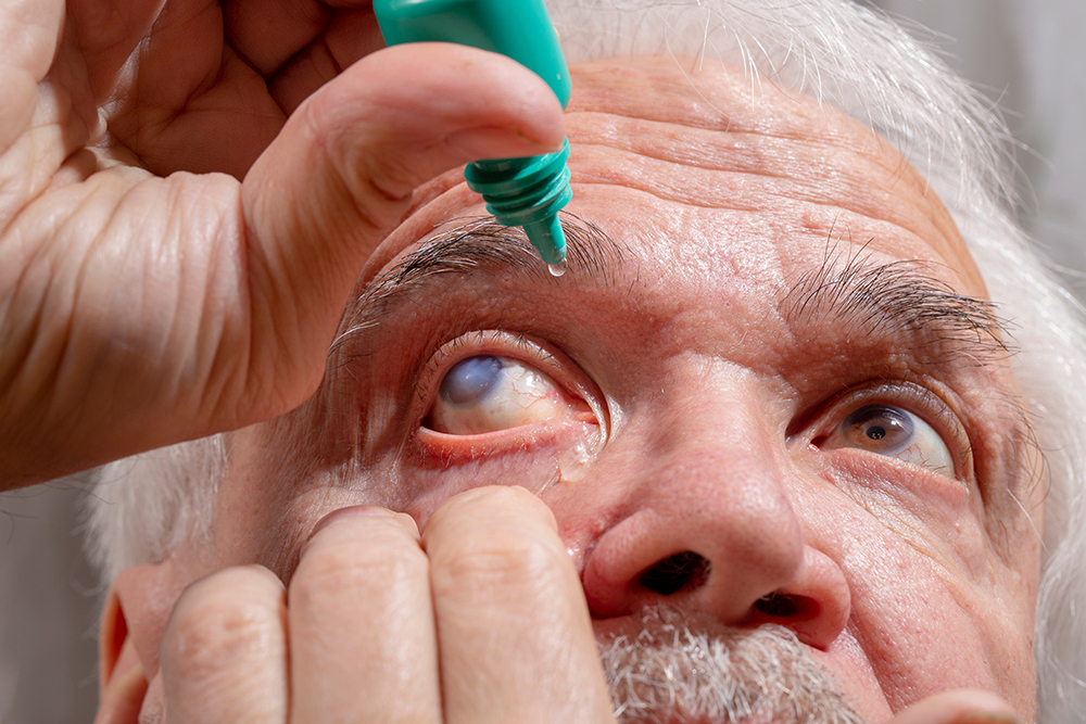 O que e Glaucoma? Fatores de Risco e Diagnostico Precoce